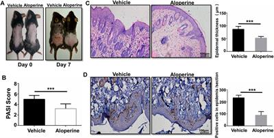 Aloperine Ameliorates IMQ-Induced Psoriasis by Attenuating Th17 Differentiation and Facilitating Their Conversion to Treg